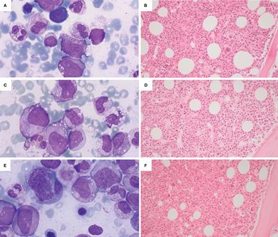 Case report: Cytopenias in VEXAS syndrome - a WHO 2022 based approach in a single-center cohort